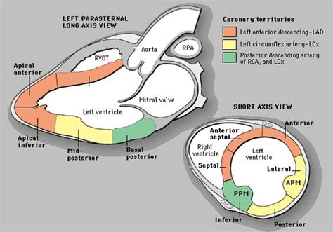 hypokinetic basal inferior wall treatment.